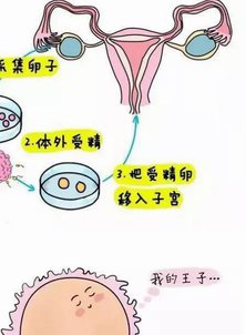 有子宫腺肌症也能尝试试管吗？数据显示35岁以下成功率还挺高