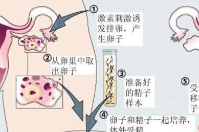 南京鼓楼医院生殖中心开展了哪些辅助生殖项目做三代试管要多少钱？