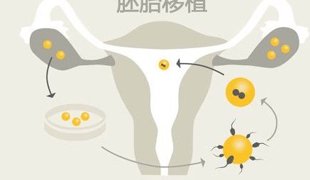 男性做试管婴儿的要求是什么？附试管婴儿男性需要满足的条件